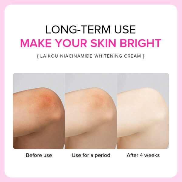 LAIKOU Under Arms Cream - 100g - Image 3